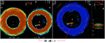 FURUNO SONAR CH600 จอภาพLCDสี12.1